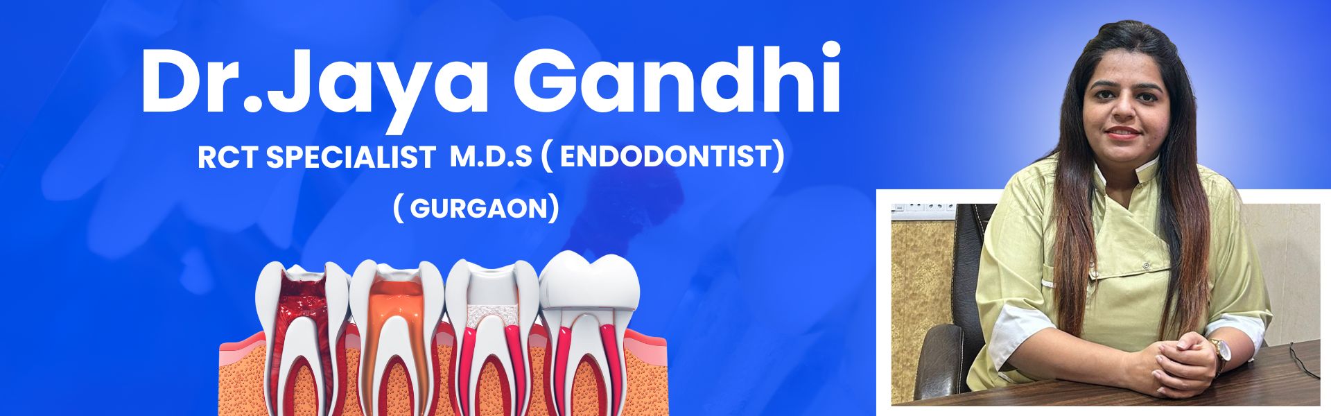 best root canal treatment in gurgaon